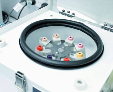 Tecnologia Centrifugadora Bri