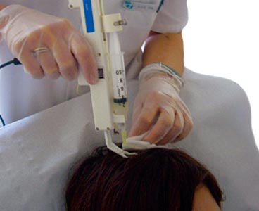 Pistola Mesoterapia DHN-1