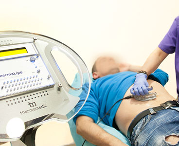Thermlipo