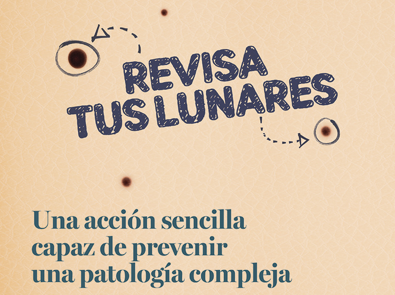 Campaña Revisión Lunares CDE
